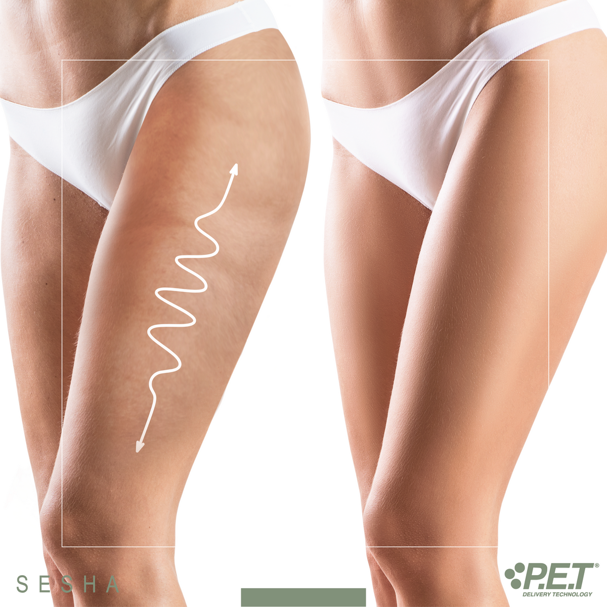 Body Care - Anti-Cellulite Body Montage