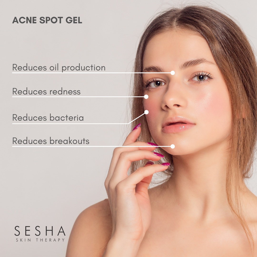 Acne - Spot Gel