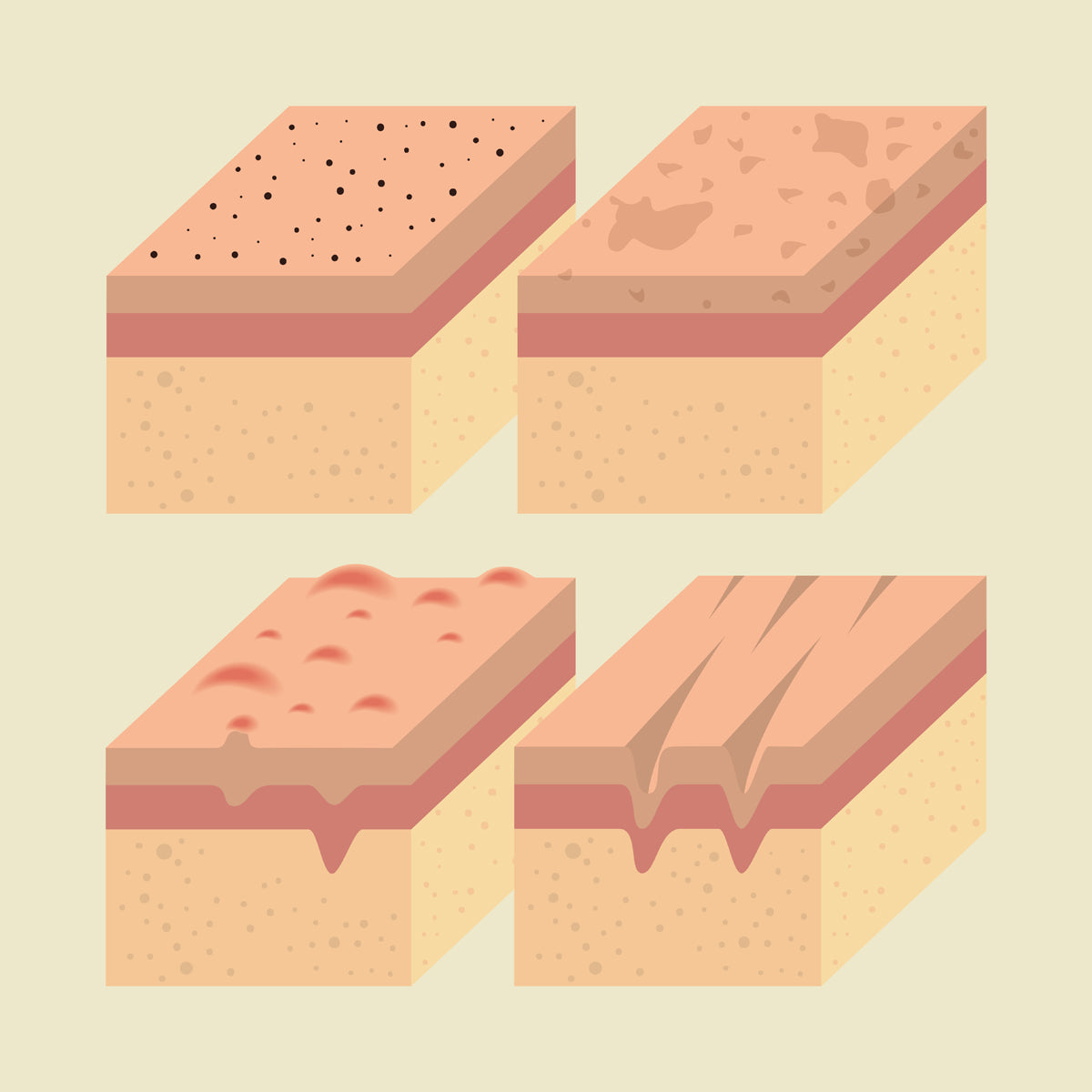 ANATOMY OF THE SKIN