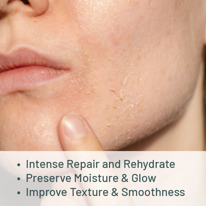 Dry Skin