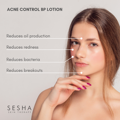 Acne - Control BP Lotion
