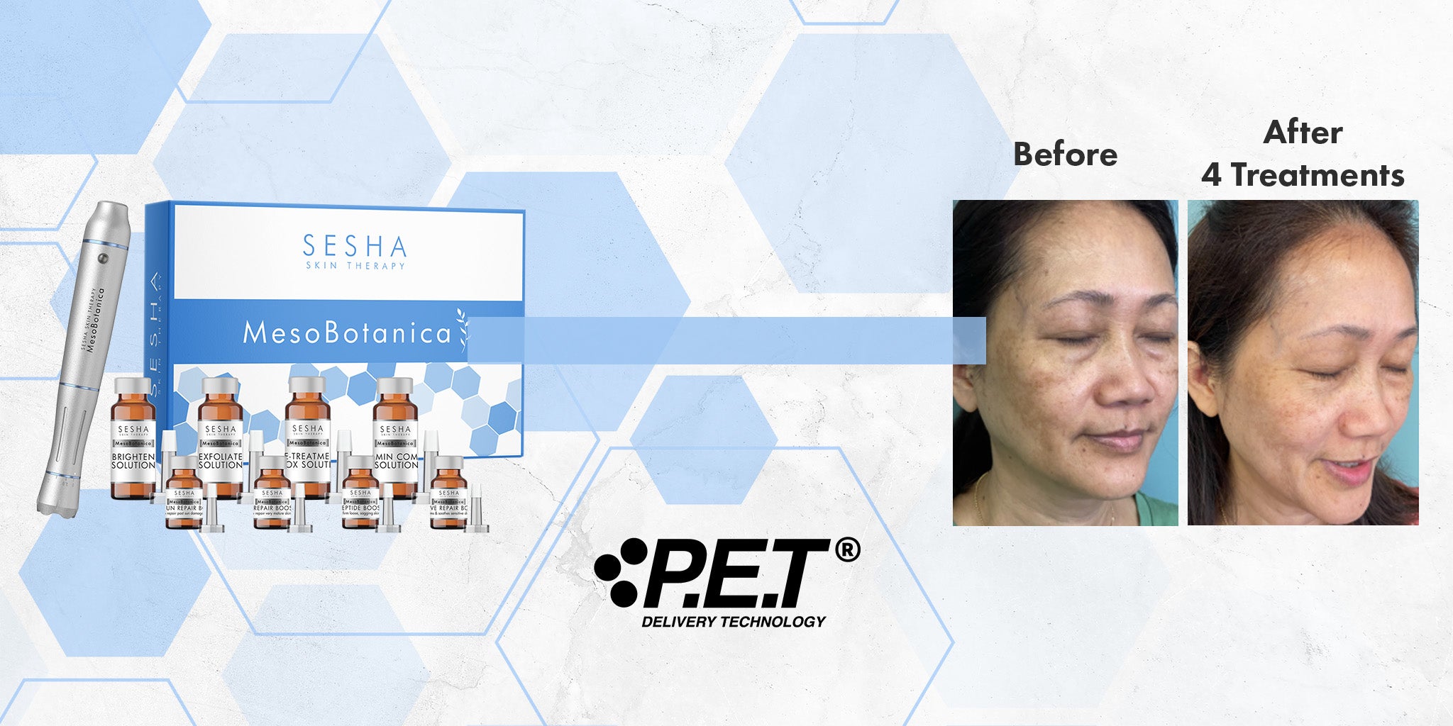 Mesobotanica Pen – a professional, science-based clinical skincare device delivering cutting-edge treatments for radiant, youthful skin. 