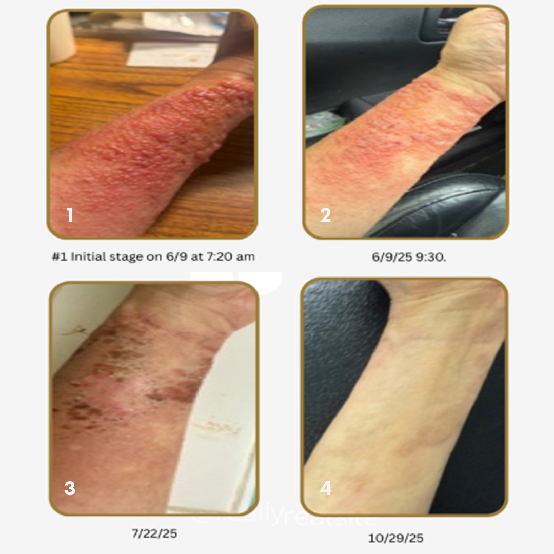 Serum - PDRN Regenerative Serum – Sesha Skin Therapy